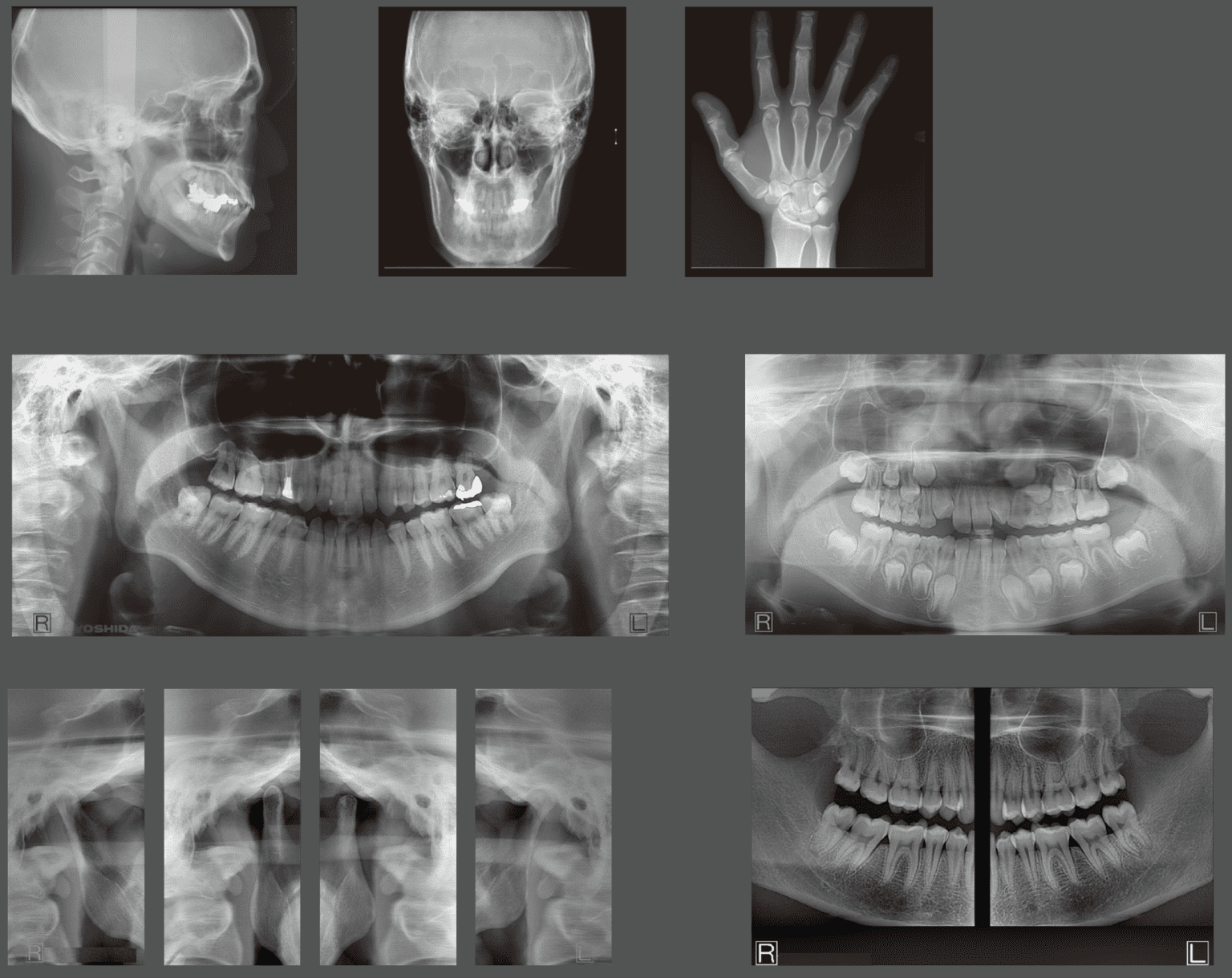 ImageWorks Dental CBCT and Panoramic XRay System Radiology Imaging Solutions