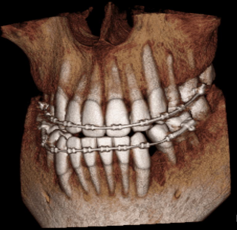 ImageWorks Dental CBCT and Panoramic XRay System Radiology Imaging Solutions