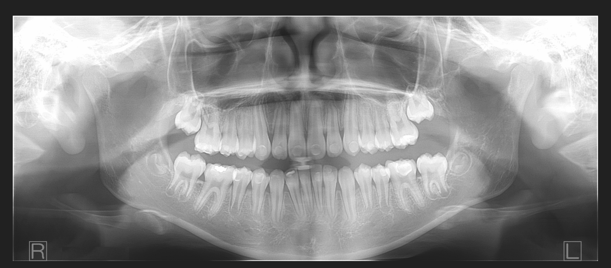 ImageWorks Dental CBCT and Panoramic XRay System Radiology Imaging