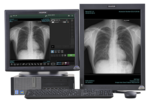 Radiology PACS System  Image Quality by Fujifilm Healthcare