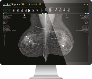 Konica Minolta Exa® PACS - Radiology Imaging Solutions